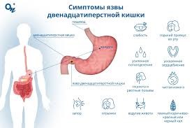СОЧЕТАННЫЕ ОСЛОЖНЕНИЯ ЯЗВЕННОЙ БОЛЕЗНИ ДВЕНАДЦАТИПЕРСТНОЙ КИШКИ: СОВРЕМЕННОЕ ПОНЯТИЕ И ПОДХОДЫ К ХИРУРГИЧЕСКОМУ ЛЕЧЕНИЮ