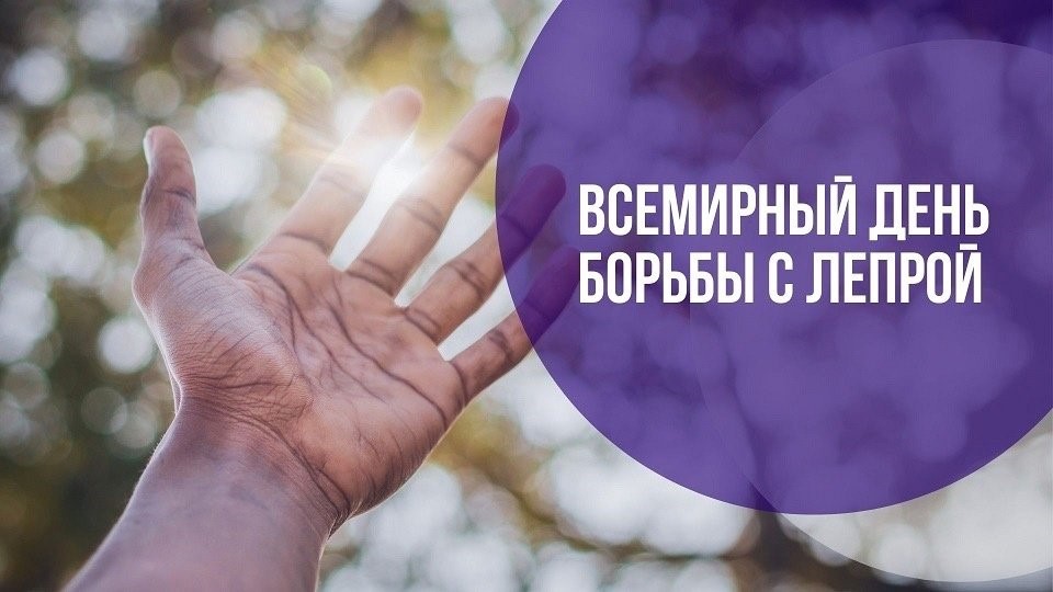 ЛЕПРА ВЧЕРА, СЕГОДНЯ, ЗАВТРА