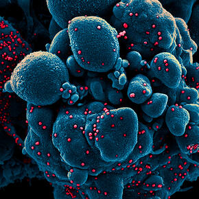 Британские медики обнаружили новую мутацию коронавируса
